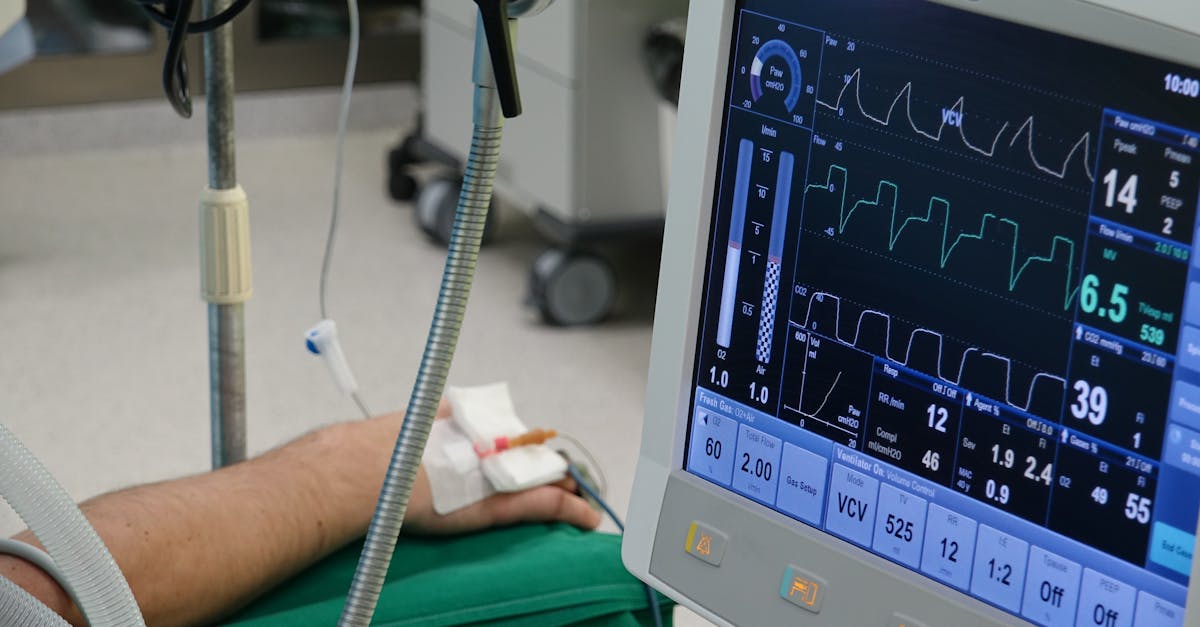 欧盟好彩四味爆珠：代理公司注册利弊